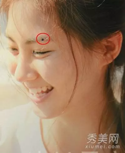 痣相看富貴財運:會給你招財的七種痣,要錢有錢,好運相伴,你有嗎?