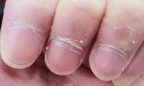 夏季孩子更易缺鋅,父母忽視,孩子長不高