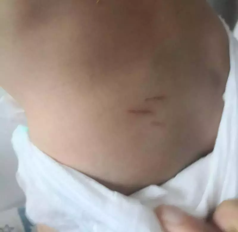 《可憐》是女傭還是獅城容嬤嬤?!16個月大的孩子背部驚現傷痕