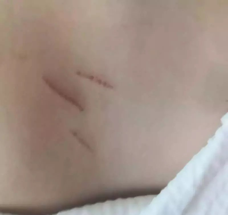 《可憐》是女傭還是獅城容嬤嬤?!16個月大的孩子背部驚現傷痕