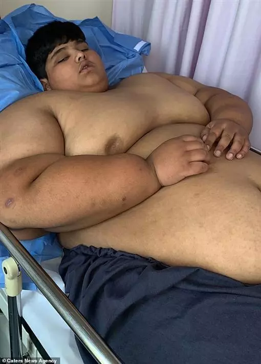 十歲體重196公斤! 全球最胖男童「整天只能躺或坐」