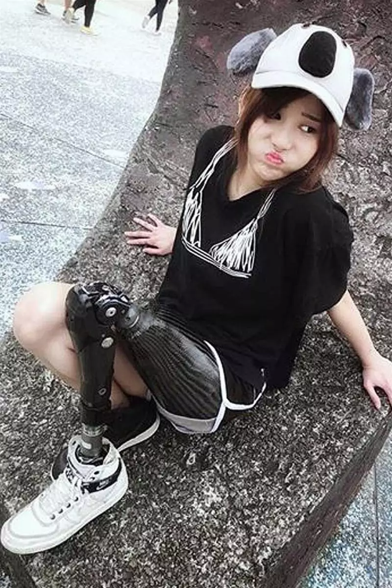 沒腿照樣健身跳舞!鋼鐵正妹證明車禍奪不走你的人生,要積極面對生活