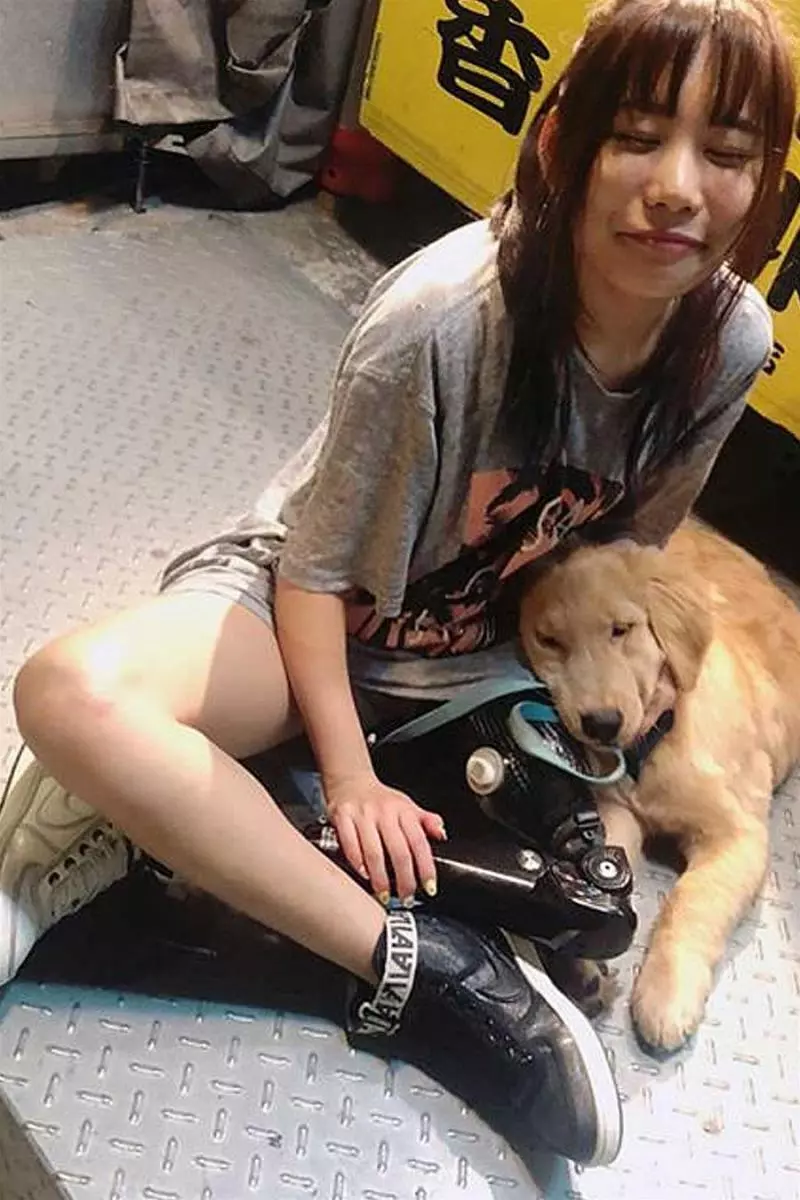 沒腿照樣健身跳舞!鋼鐵正妹證明車禍奪不走你的人生,要積極面對生活