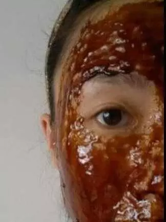 教你一個去皺紋方法,很多大姐都在用