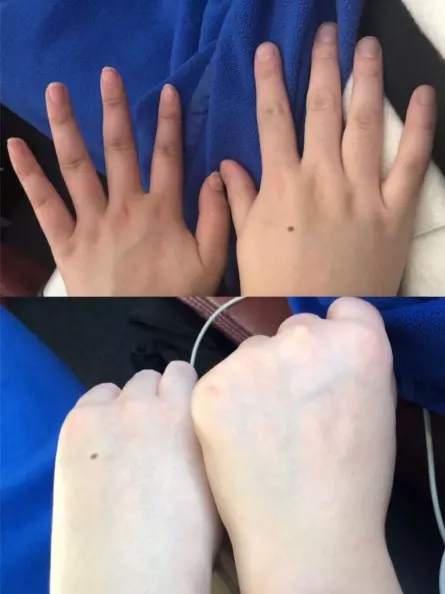 36歲女子在家自製超強「檸檬酵素」,從57kg瘦到51kg,連皮膚都跟著白到發光
