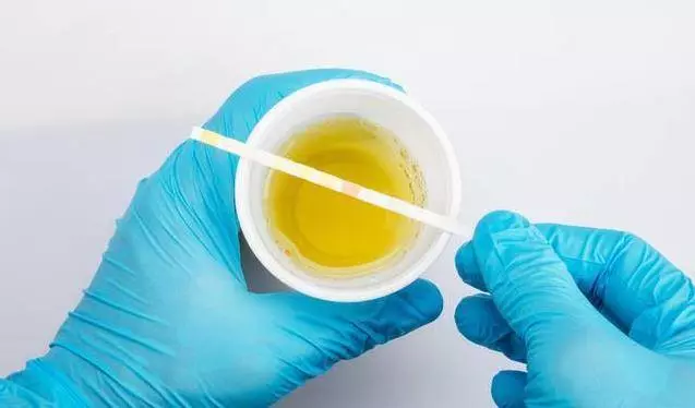 肝不好的人,上廁所時會有3大「表現」,若占一個,提醒你需養肝了