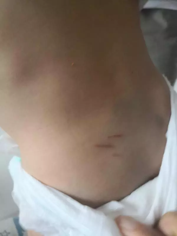 喂食不熟蘿蔔 亂剪女嬰頭髮 女傭被炒後 抓傷女嬰背