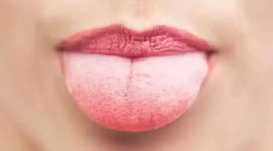 身上有個排濕出口,1天拍打100下,一身濕氣全排空