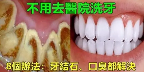 牙垢太多很難清理?教你「8個小竅門」,不用找牙醫,口臭、結石、大黃牙一次都解決!