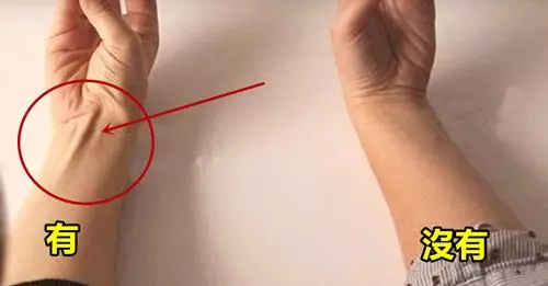 快看看自己的手腕! 有這根筋的人「性格命運大不同」,據說很準!