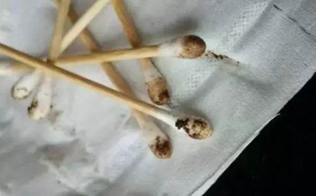 貓咪因耳蟎導致繼發性中耳炎的治療方法