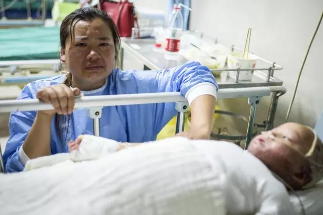 4歲女童全身嚴重燒傷,崩潰痛哭:「哥哥為什麼要拿火燒我」
