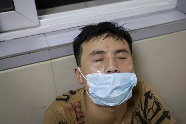 4歲女童全身嚴重燒傷,崩潰痛哭:「哥哥為什麼要拿火燒我」