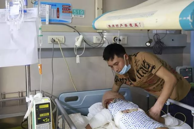 4歲女童全身嚴重燒傷,崩潰痛哭:「哥哥為什麼要拿火燒我」
