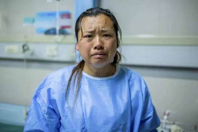 4歲女童全身嚴重燒傷,崩潰痛哭:「哥哥為什麼要拿火燒我」