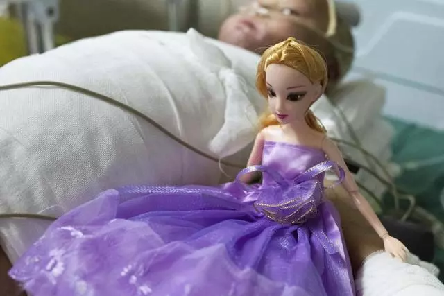 4歲女童全身嚴重燒傷,崩潰痛哭:「哥哥為什麼要拿火燒我」