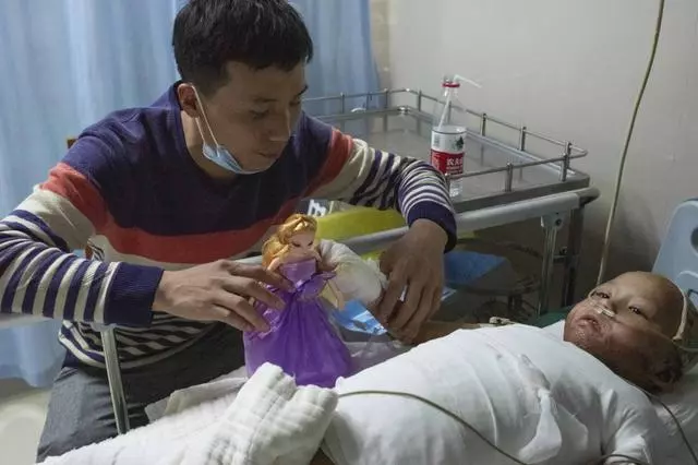 4歲女童全身嚴重燒傷,崩潰痛哭:「哥哥為什麼要拿火燒我」