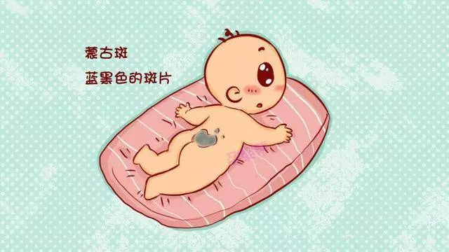 這2種胎記是疾病的預兆,媽媽們要謹慎處理