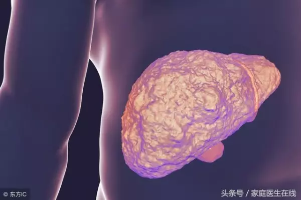 肝臟不會喊痛!肝癌晚期才有症狀,千萬別疏忽!