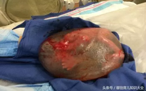 孕婦懷胎十月還沒發動,剖開腹部散發一股惡臭,醫生痛駡孕婦無知!