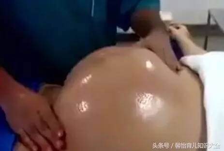 孕婦懷胎十月還沒發動,剖開腹部散發一股惡臭,醫生痛駡孕婦無知!