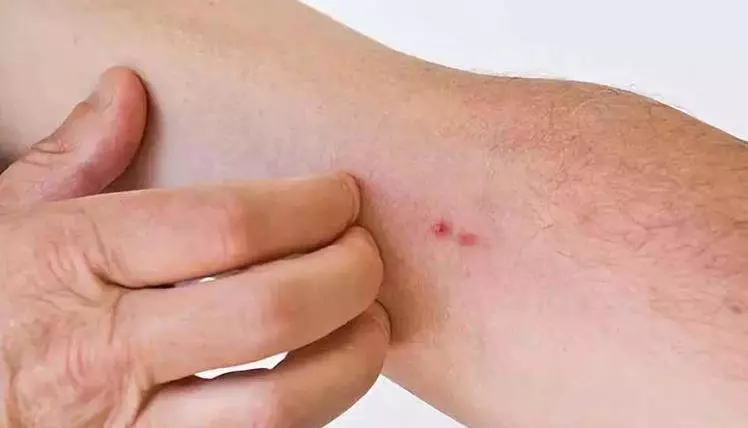 體內有病,皮膚先行?皮膚出現3種「異常」,【病】離你已經很近了