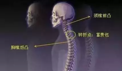 頸椎「有坨肉」號稱「富貴包」,其實是「奪命包」!是「腦梗」的前兆,教你三招解決它!