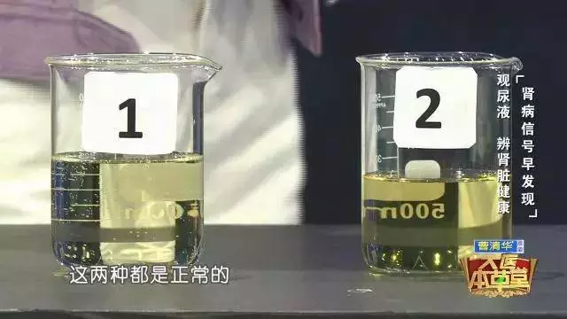 別再這樣喝水了,小心親手毀掉自己的腎!喝水有「 3 不 10 要」,做對一輩子遠離醫生!