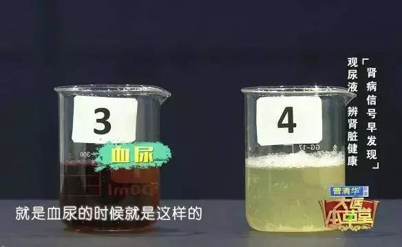 別再這樣喝水了,小心親手毀掉自己的腎!喝水有「 3 不 10 要」,做對一輩子遠離醫生!