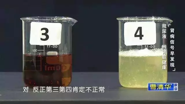 別再這樣喝水了,小心親手毀掉自己的腎!喝水有「 3 不 10 要」,做對一輩子遠離醫生!