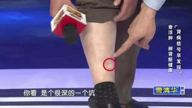 別再這樣喝水了,小心親手毀掉自己的腎!喝水有「 3 不 10 要」,做對一輩子遠離醫生!