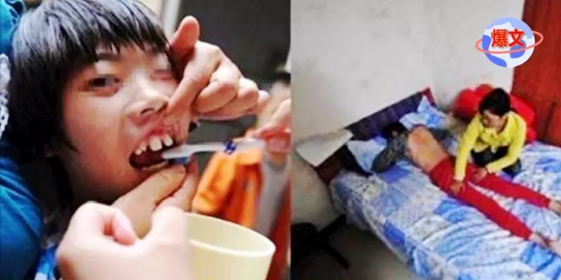 媽媽給智障女兒買了孤兒丈夫,兩人誤打誤撞懷上寶寶, 生孩子時丈夫讓眾人都嚇傻了!!