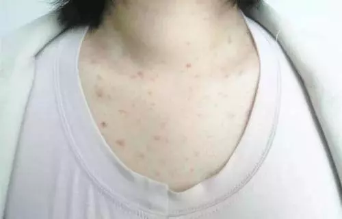 百萬蟎蟲藏在床上,3招幫你除的乾乾淨淨