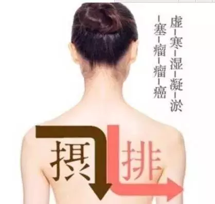 萬病之源就是寒濕體質,請注意!