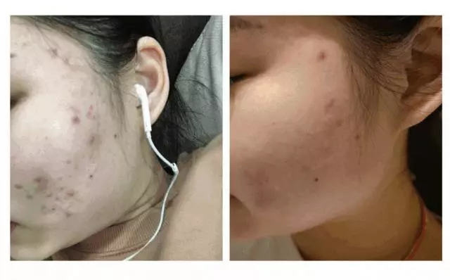 為什麼那麼多中國女孩來了新加坡,都變得越來越美了