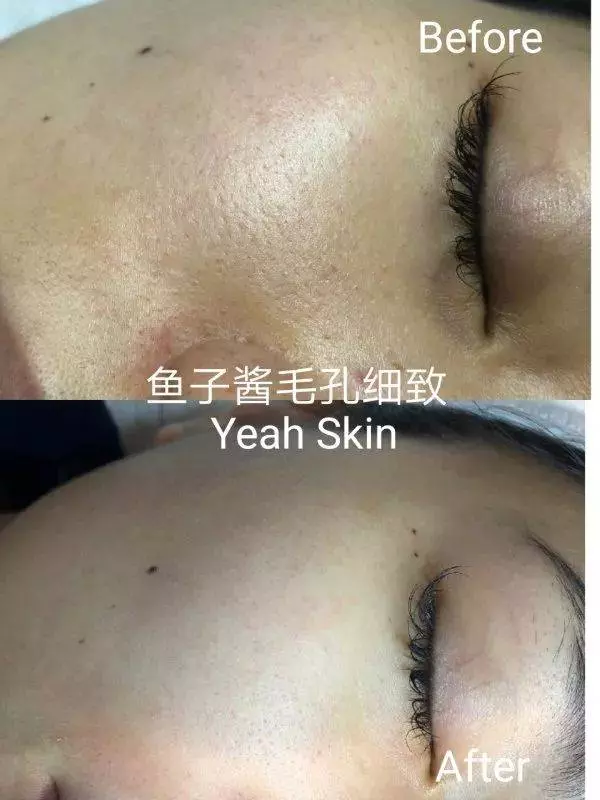 為什麼那麼多中國女孩來了新加坡,都變得越來越美了