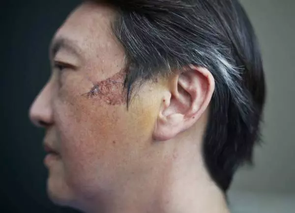 路旁割草車擊中石頭 飛進車 壁球裁判臉頰被割傷