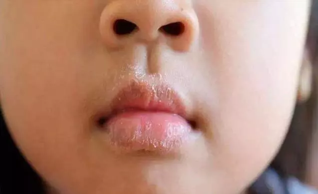 4種表現「暗示」你,寶寶脾胃出現了問題,4招調理脾胃簡單管用