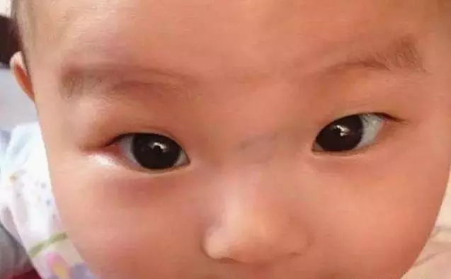 4種表現「暗示」你,寶寶脾胃出現了問題,4招調理脾胃簡單管用