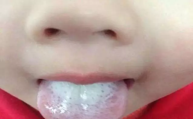 4種表現「暗示」你,寶寶脾胃出現了問題,4招調理脾胃簡單管用