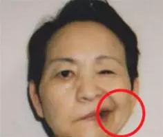 「方岑」驚罹「帕金森氏症」退出演藝圈,發病前「十大早期徵兆」須當心,無法根治的腦退化真相
