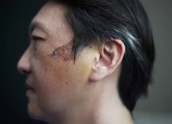 割草車片擊中石頭 男子瞬間變血人