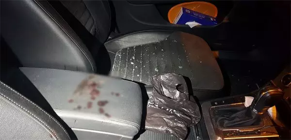割草車片擊中石頭 男子瞬間變血人