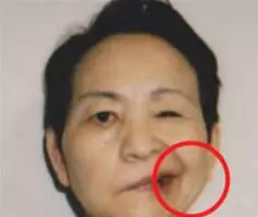 「帕金森氏症」發病前「十大早期徵兆」須當心,無法根治的腦退化真相