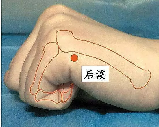 穴位我們怎麼在治療疾病中更好的運用