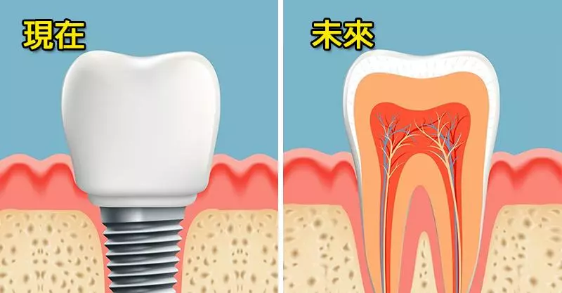 科學家找到「2個月重新長牙」的新技術 價錢公布「比假的還便宜」!