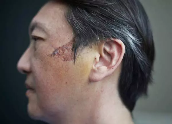 【新加坡】 路旁割草車擊中石頭 飛進車 壁球裁判臉頰被割傷 !