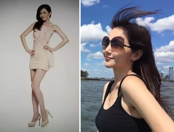 41歲美魔女「不運動」,身材竟比20歲時還火辣!沒想到去年她到醫院檢查,卻發現自己得了「這種病」,讓人頭皮發麻...