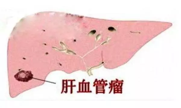 41歲美魔女「不運動」,身材竟比20歲時還火辣!沒想到去年她到醫院檢查,卻發現自己得了「這種病」,讓人頭皮發麻...
