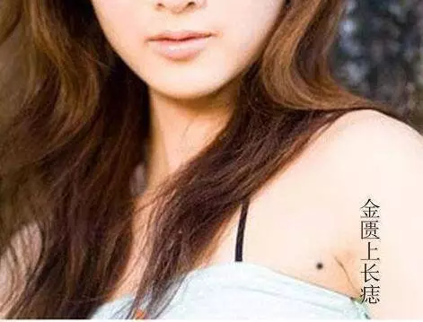女人身上有這【四顆痣】天生財運好,多貴人相助